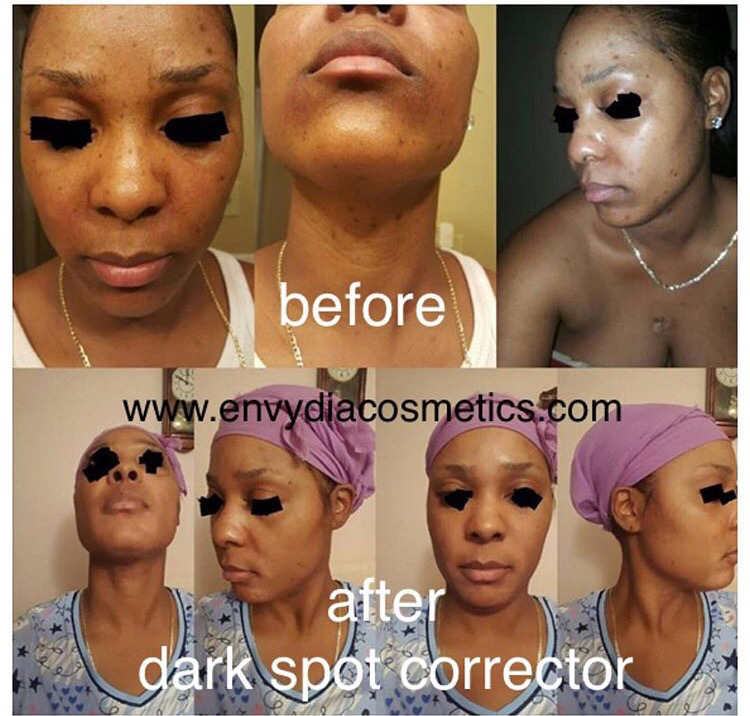 Dark Spot Corrector 60G