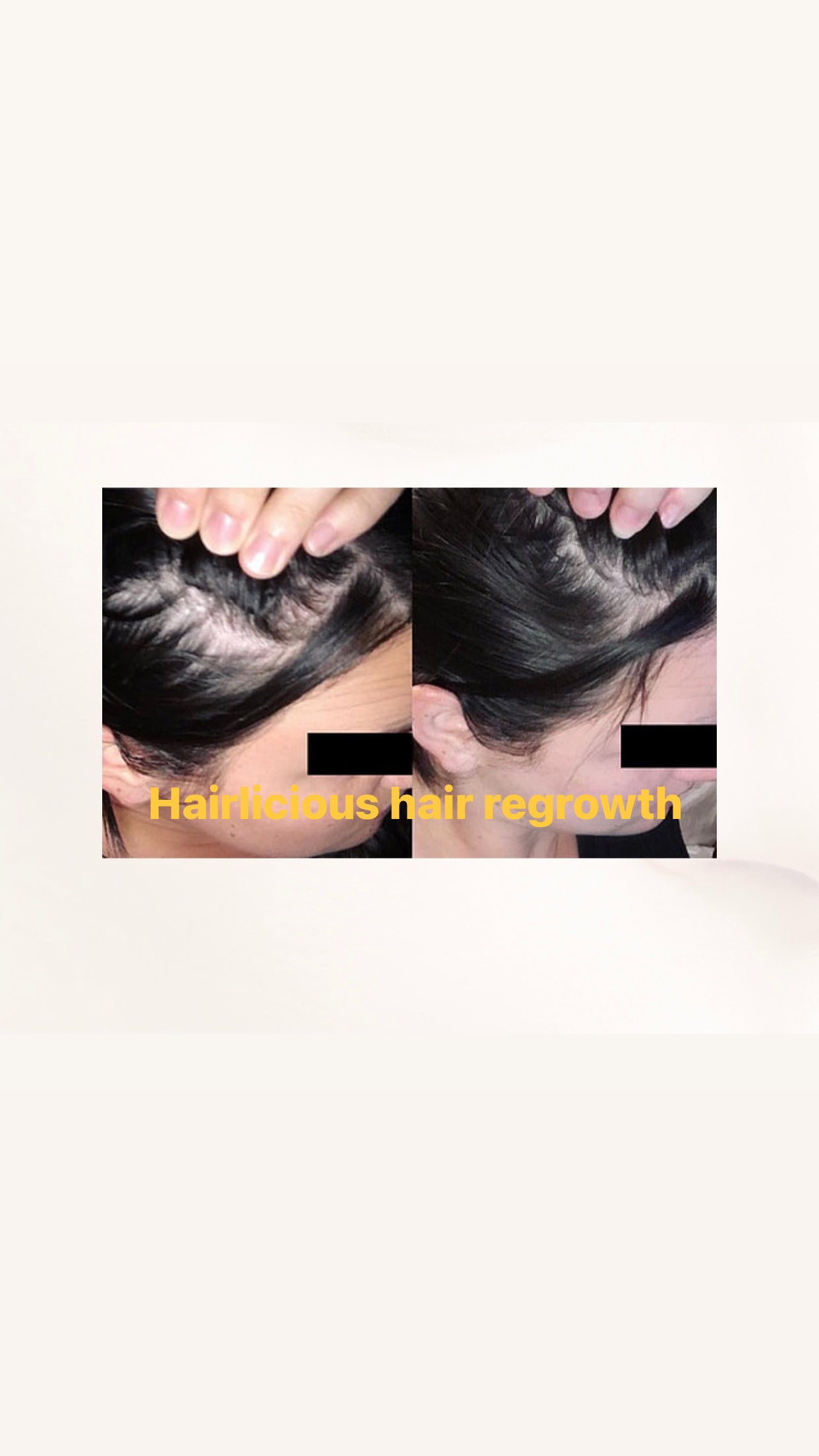 Hairlicious Regrowth Invigorating Serum